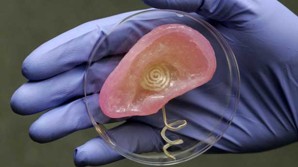 3D printed bionic Ear