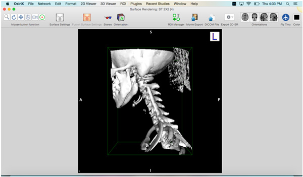 CT scan for 3D printing